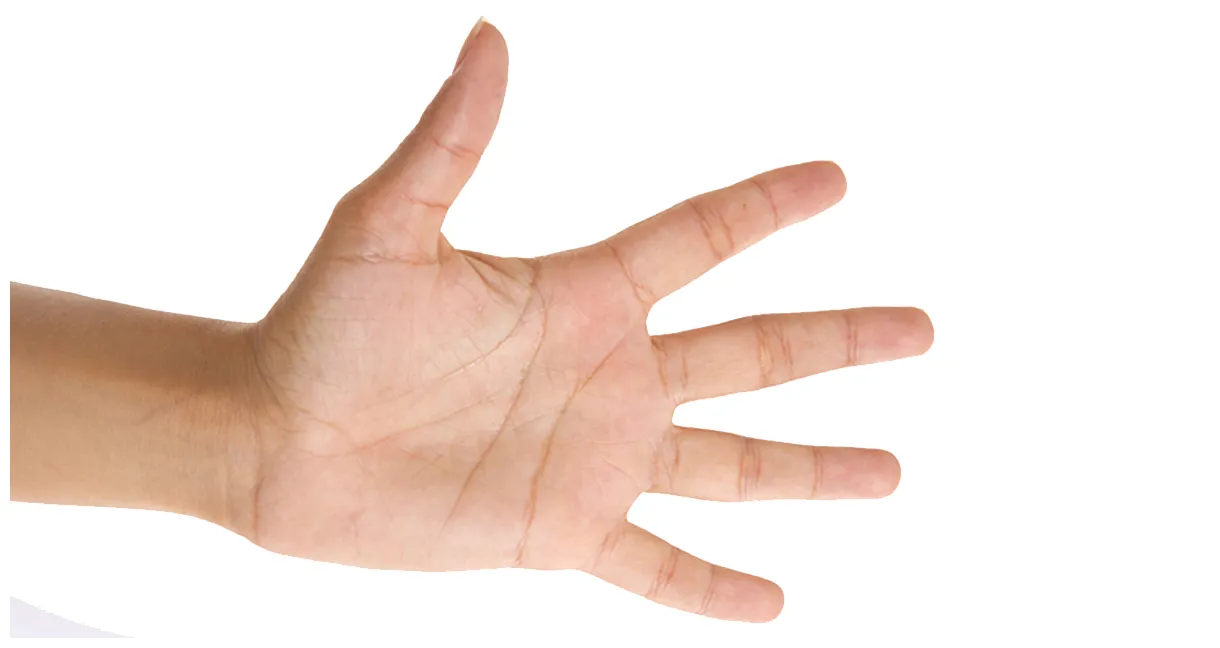 Hand conditions ocala, fl dr. karl siebuhr, md reconstructive